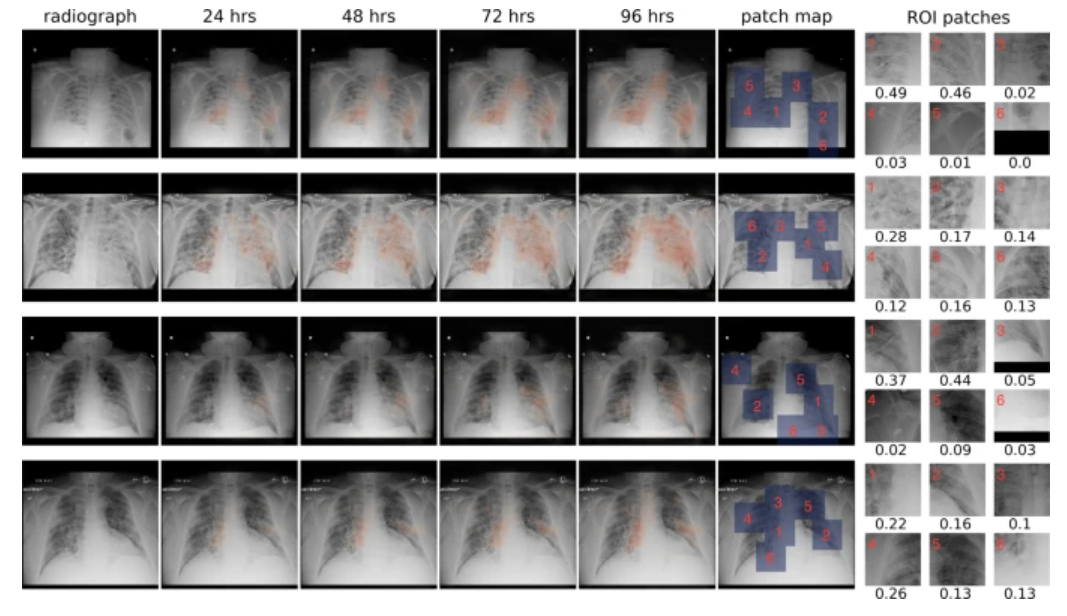 马斯克、米哈游轮番注资,AI医疗会是下一个风口吗?