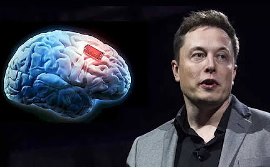 马斯克:首位植入Neuralink大脑芯片的患者“恢复良好” 马斯克:首位植入Neuralink大脑芯片的患者“恢复良好”